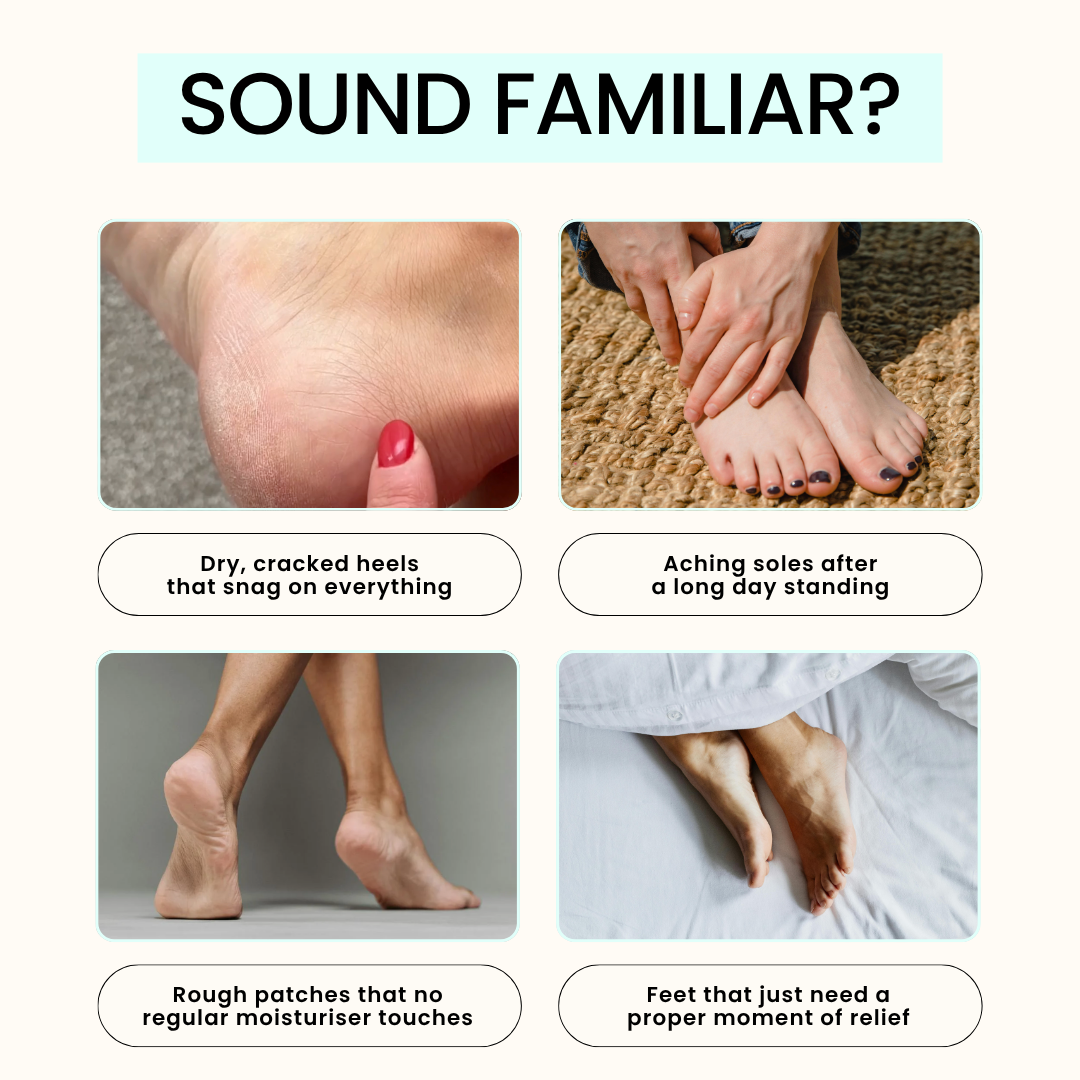 Peppermint Foot Balm
